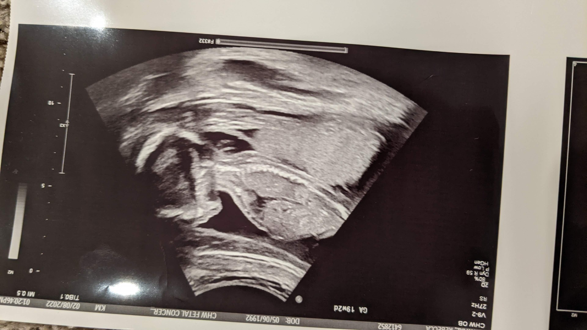 Our Second Son in Ultrasound