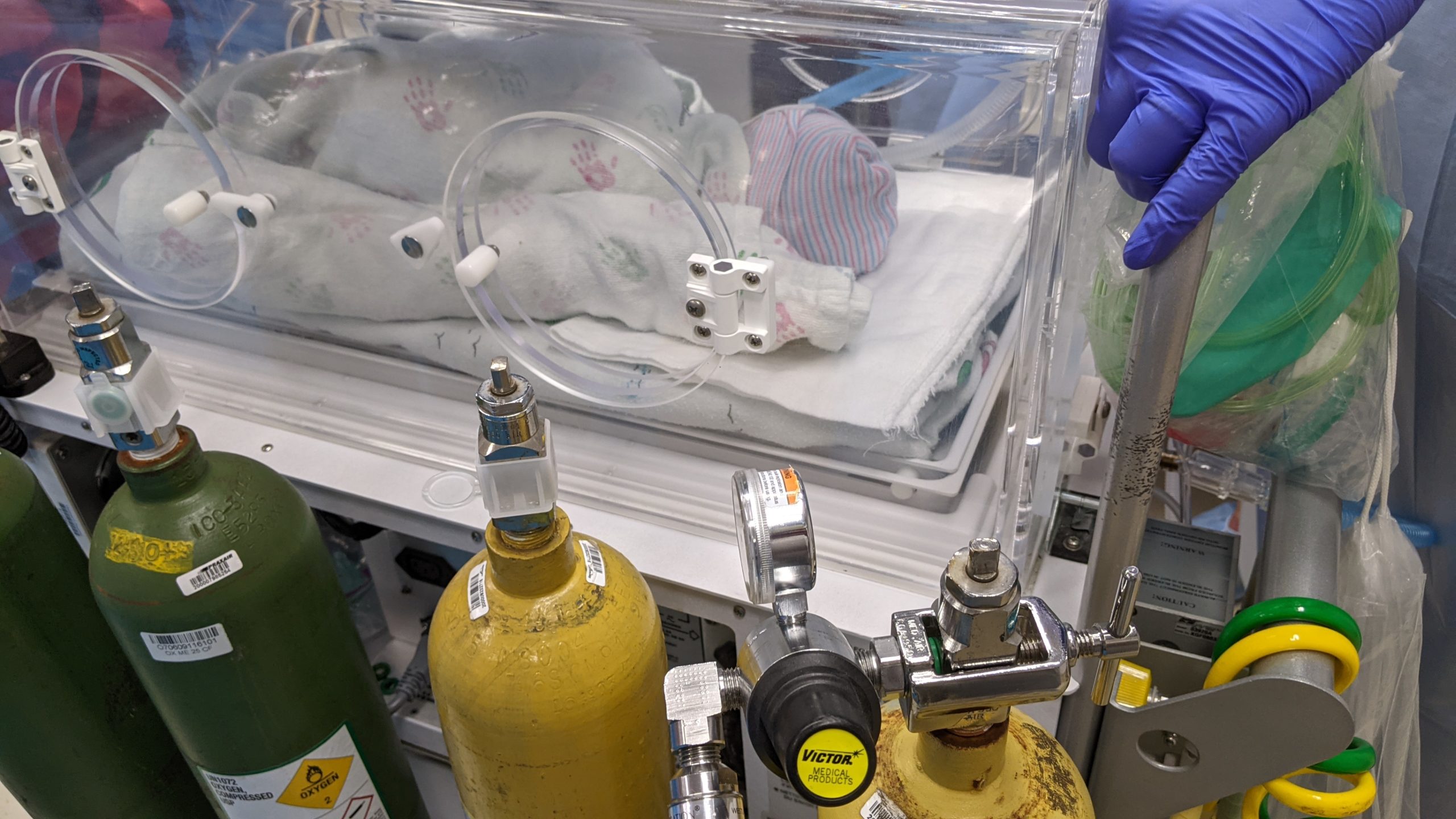 Wyatt on ventilator being carted to the NICU